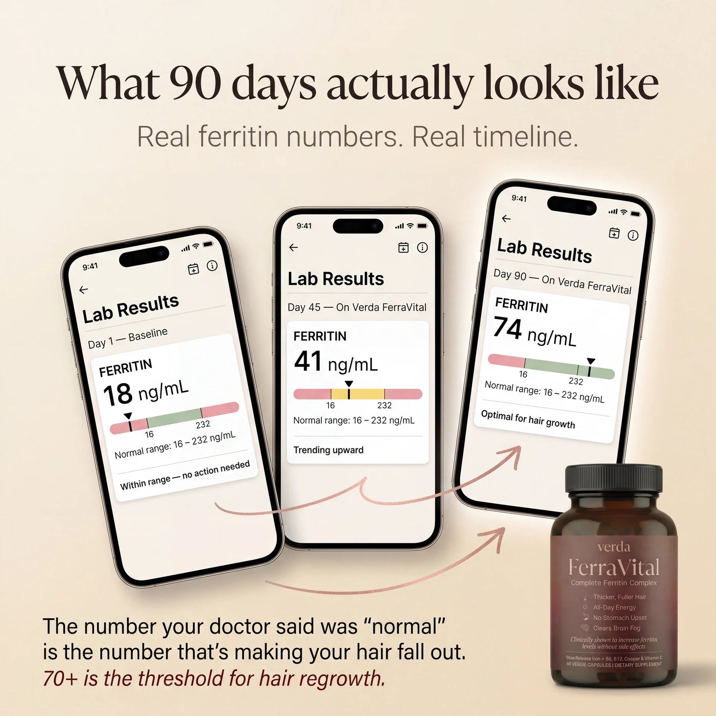 Ferritin Support Complex